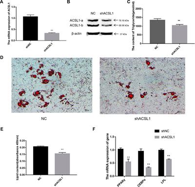 Transcript variants of long-chain acyl-CoA synthase 1 have distinct roles in sheep lipid metabolism